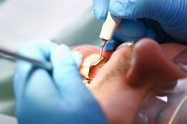 Best Broken or Cracked Tooth Emergency Dentist in Lago Vista, TX
